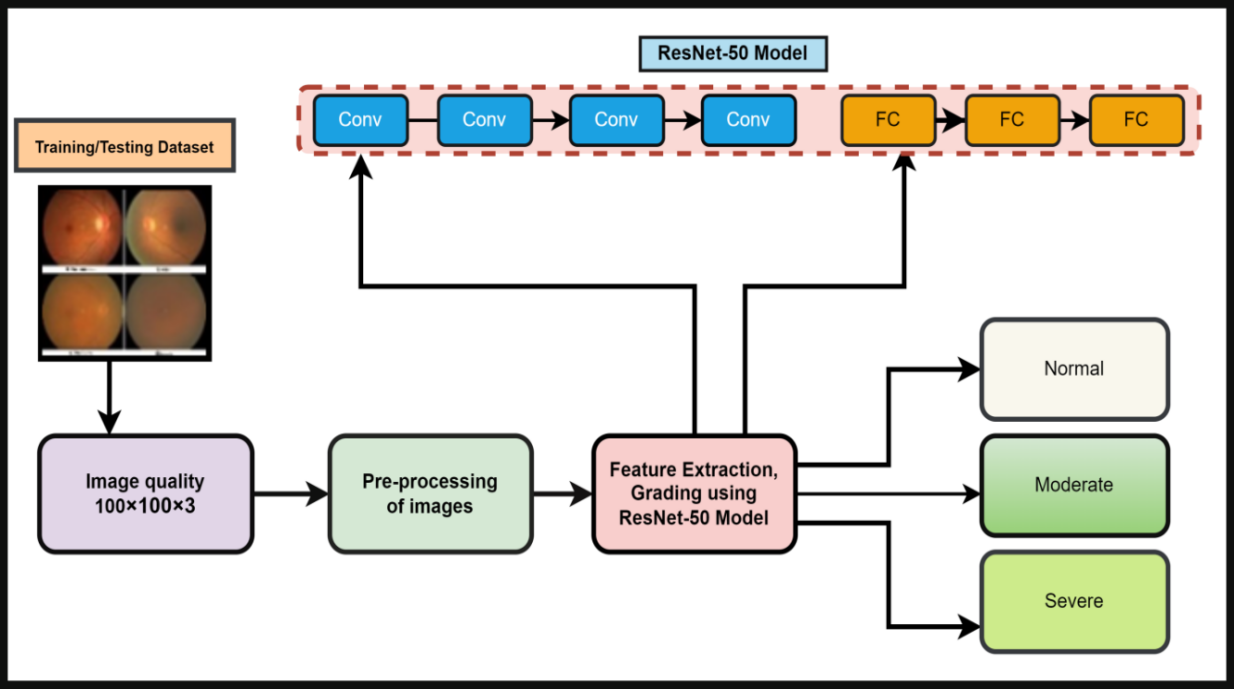 Enhancing Ocular Health Precision: Cataract Detection Using Fundus Images and ResNet-50