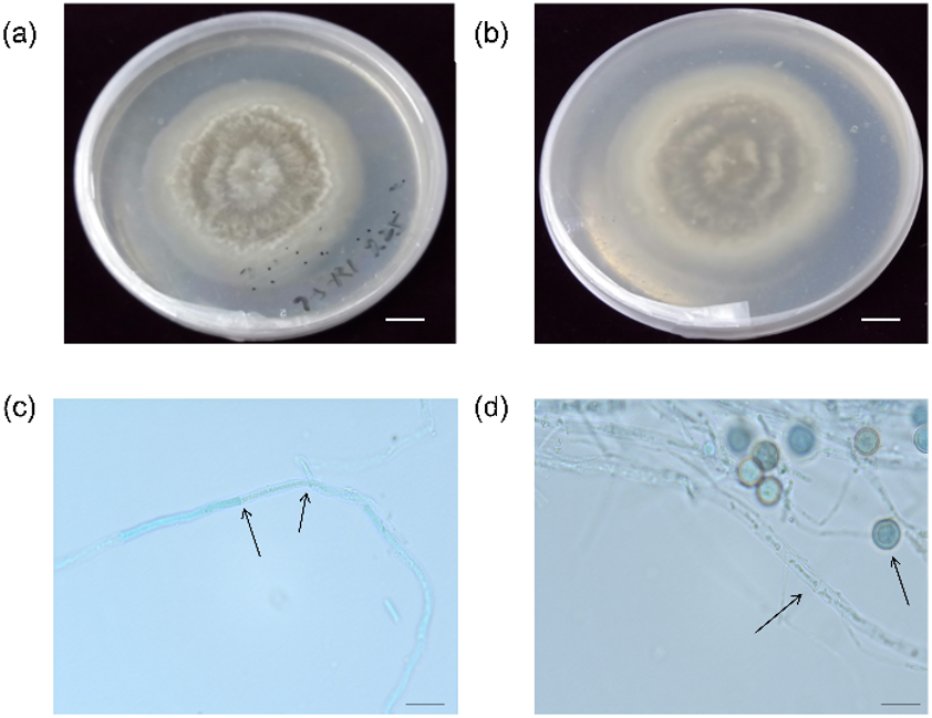 A Novel Huperzine A-producing Endophytic Fungus NWUHS002 Isolated from Huperzia Serrata Trev.